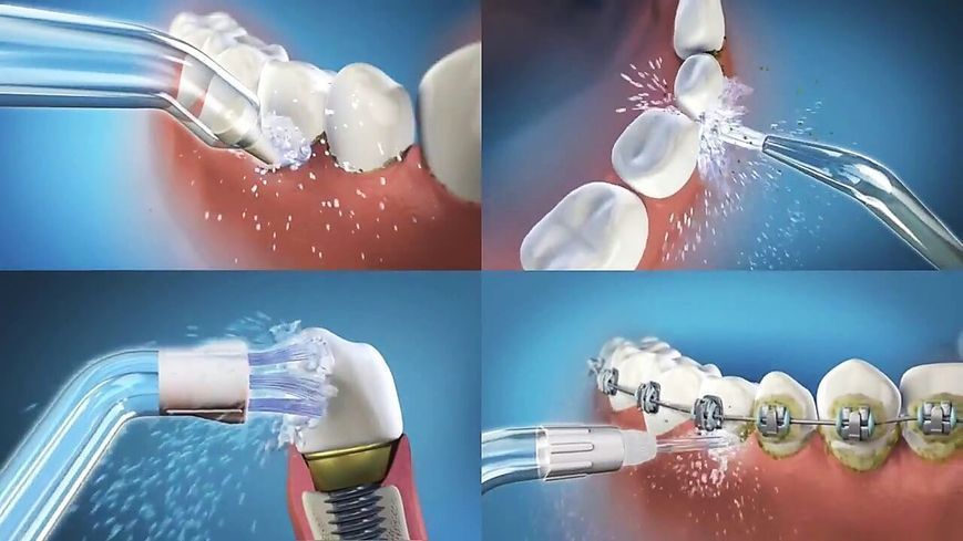 Портативний іригатор для ротової порожнини Oral InnoTech LS2377 фото
