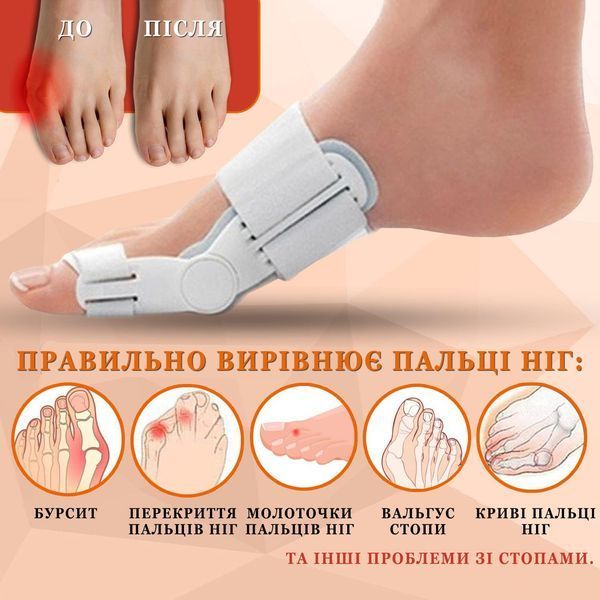 Ортопедична вальгусна шина-коректор BodyBalance ProFlex BD-4312 фото
